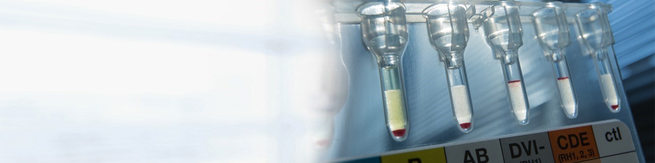 Pre Analytics | Freiburg Medical Laboratory, Dubai